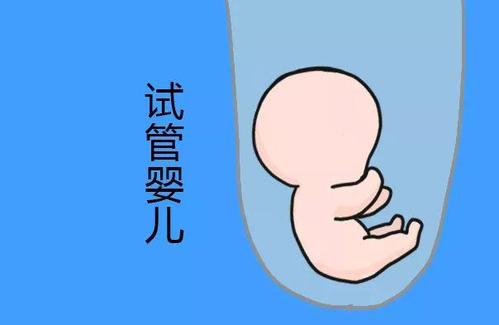 测序平台